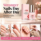 💅 Nail Strengthener for Soft Nails – Soft nails és tökéletlenségek ellen – Utánvét ✨