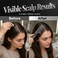 💇 Scalp Applicator Comb Tool – Hajápoló fésű fejbőrhöz, egyenletes felvitel – Utánvét ✨